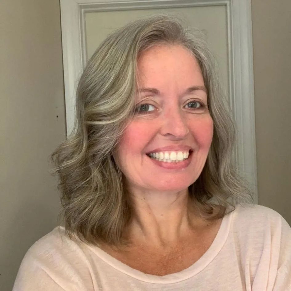 Customer Kelli M. smiling, showing her skin improvement